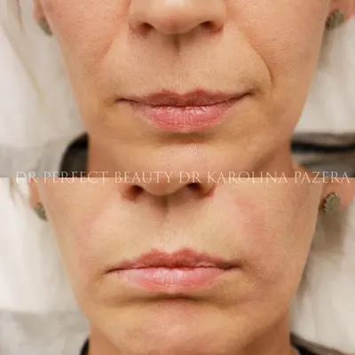 Dr Karolina Ziemlewska - Medycyna Estetyczna i Kosmetologia